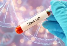 Stem Cell Conditions and Indications: When Is Stem Cell Therapy Recommended?