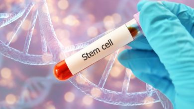 Stem Cell Conditions and Indications: When Is Stem Cell Therapy Recommended?
