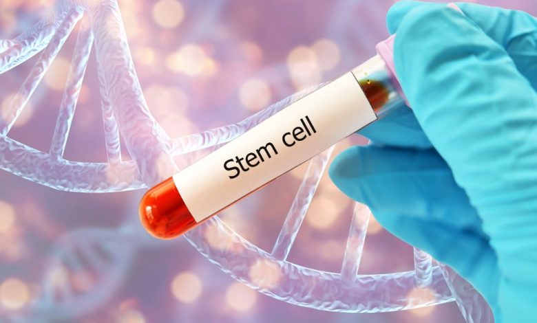 Stem Cell Conditions and Indications: When Is Stem Cell Therapy Recommended?